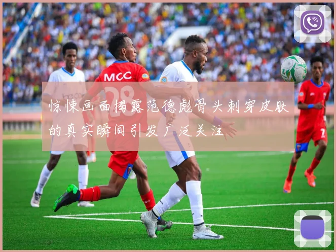惊悚画面揭露范德彪骨头刺穿皮肤的真实瞬间引发广泛关注